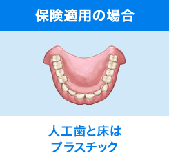 保険適用の場合 人工歯と床はプラスチック