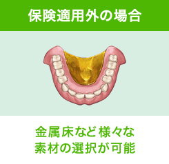 保険適用外の場合 金属床など様々な素材の選択が可能