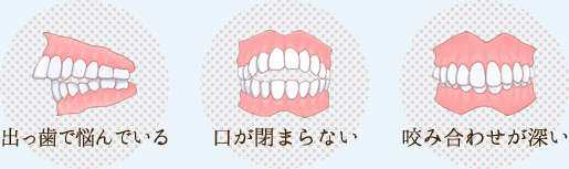 出っ歯で悩んでいる 口が閉まらない 噛み合わせが悪い